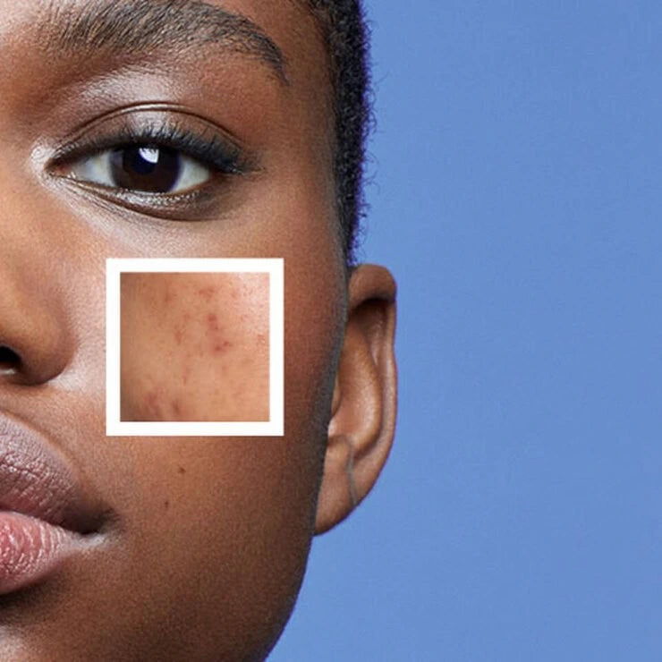 Skincare tips and advice